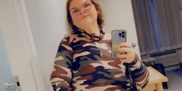 1000-Lb. Sisters’ Tammy Slaton Shares Raw Recovery Photos After Major Skin Removal Surgery