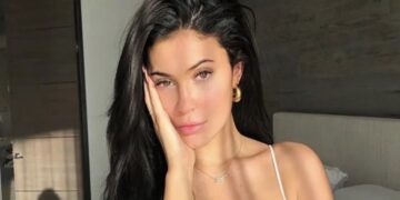 Kylie Jenner Talks Candidly About All the Plastic Surgery She’s Done and What Are Rumors
